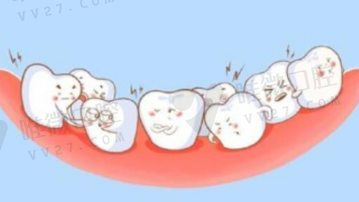 牙齿龈缘在哪个部位（牙齿的颊侧是哪个部位）